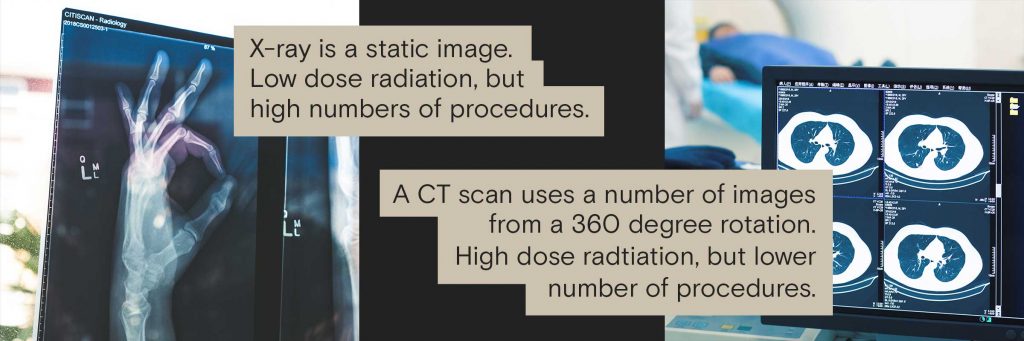 X-ray is a static image. Low dose of radiation, but high numbers of procedures. A CT scan uses a number of images from a 360-degree rotation. High-dose radiation, but a lower number of total procedures.