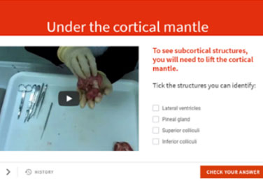 Brain dissection as part of biopsychology subject